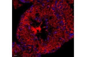 Immunofluorescence of paraffin embedded mouse spleen using cfap58 (ABIN7073535) at dilution of 1: 650 (400x lens) (CCDC147 anticorps)