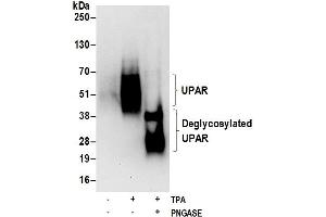 Western Blotting (WB) image for anti-Plasminogen Activator, Urokinase Receptor (PLAUR) (AA 150-200) antibody (ABIN7453240)