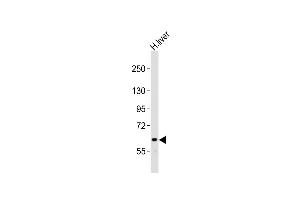 Anti-NOTCH4 Antibody (C-term)at 1:2000 dilution + human liver lysates Lysates/proteins at 20 μg per lane. (NOTCH4 anticorps  (C-Term))