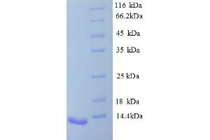 SDS-PAGE (SDS) image for Arginine Vasopressin Receptor 1B (AVPR1B) (AA 343-425), (partial) protein (His tag) (ABIN5712992)