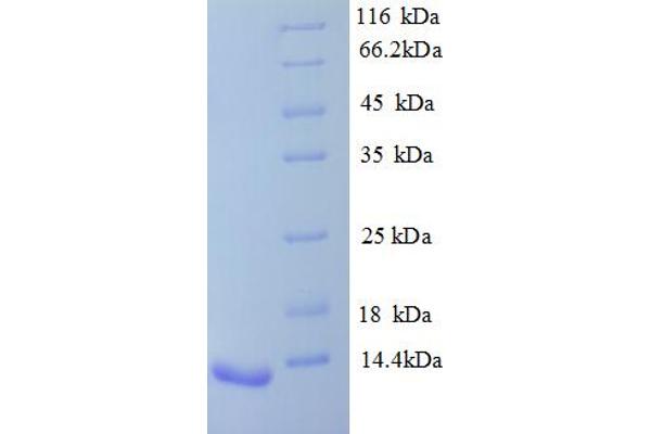 AVPR1B Protein (AA 343-425, partial) (His tag)