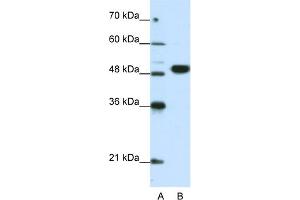 WB Suggested Anti-EIF4A2 Antibody Titration:  0. (EIF4A2 anticorps  (N-Term))