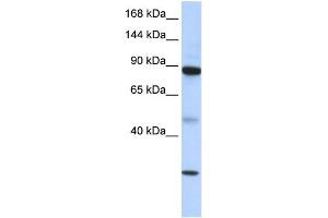 WB Suggested Anti-TDRD9 Antibody Titration: 0. (TDRD9 anticorps  (Middle Region))