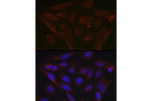 Immunofluorescence analysis of U2OS cells using PDK4 Rabbit pAb (ABIN6132477, ABIN6145396, ABIN6145397 and ABIN6217290) at dilution of 1:100 (40x lens).