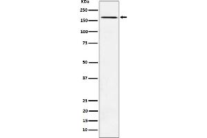 Western blot analysis of AGL expression in K562 cell lysate.