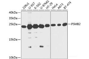 Western blot analysis of extracts of various cell lines using PSMB2 Polyclonal Antibody at dilution of 1:1000.