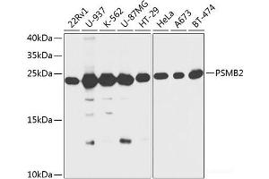 Western blot analysis of extracts of various cell lines using PSMB2 Polyclonal Antibody at dilution of 1:1000. (PSMB2 anticorps)