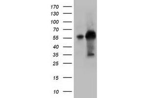 Western Blotting (WB) image for anti-Kelch-Like 2, Mayven (KLHL2) (AA 1-100), (AA 494-593) antibody (ABIN1490547) (KLHL2 anticorps  (AA 1-100, AA 494-593))