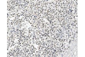 IHC analysis of DAZL using anti-DAZL antibody (ABIN7601384). (DAZL anticorps  (AA 34-281))