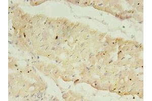 Immunohistochemistry of paraffin-embedded human heart tissue using ABIN7168600 at dilution of 1:100