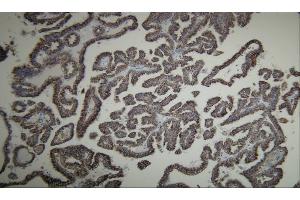 Immunohistochemistry (IHC) image for anti-alpha-Methylacyl-CoA Racemase (AMACR) (AA 367-381), (C-Term) antibody (ABIN7598787) (AMACR anticorps  (C-Term))