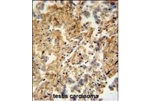 ZMYND10 Antibody (C-term) (ABIN652018 and ABIN2840499) immunohistochemistry analysis in formalin fixed and paraffin embedded human testis carcinoma followed by peroxidase conjugation of the secondary antibody and DAB staining.