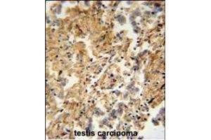 ZMYND10 Antibody (C-term) (ABIN652018 and ABIN2840499) immunohistochemistry analysis in formalin fixed and paraffin embedded human testis carcinoma followed by peroxidase conjugation of the secondary antibody and DAB staining. (ZMYND10 anticorps  (C-Term))