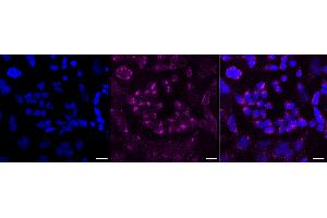 Immunocytochemical staining of HeLa cells with Alkaline phosphatase antibody (ABIN7797575), 1:1,000). (Recombinant Alkaline Phosphatase anticorps)