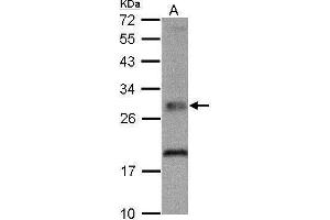 WB Image TPK1 antibody detects TPK1 protein by Western blot analysis. (TPK1 anticorps)