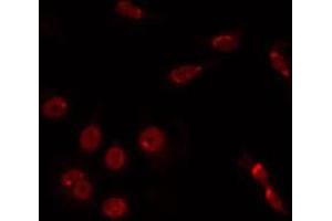 ABIN6266768 staining HuvEc by IF/ICC. (TINF2 anticorps  (Internal Region))