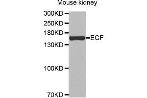 Western Blotting (WB) image for anti-Epidermal Growth Factor (EGF) antibody (ABIN3016522)