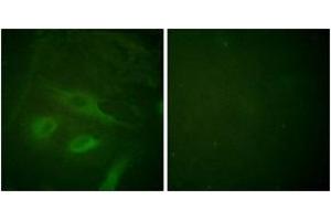 Immunofluorescence analysis of HeLa cells, using IkappaB-epsilon (Ab-22) Antibody. (IkappaB-epsilon anticorps  (AA 131-180))
