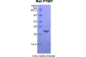 SDS-PAGE analysis of Rat FTMT Protein. (Ferritin Mitochondrial Protéine)