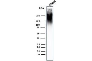 Western Blot Analysis of human brain tissue lysate using Neurofilament MAb (SPM563). (NEFH anticorps)