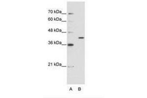 Image no. 1 for anti-Exoribonuclease 1 (ERI1) (AA 231-280) antibody (ABIN202308) (ERI1 anticorps  (AA 231-280))