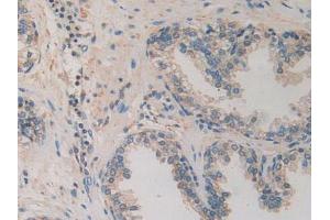 IHC-P analysis of Human Prostate Gland Tissue, with DAB staining. (CACYBP anticorps  (AA 2-228))