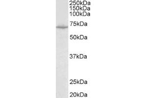 Antibody (0. (SLC6A8 anticorps  (Internal Region))