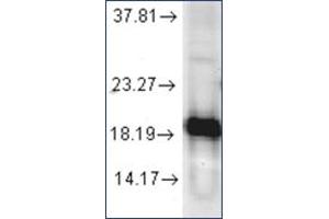 Image no. 1 for anti-Superoxide Dismutase 1, Soluble (SOD1) antibody (ABIN264854) (SOD1 anticorps)