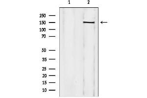 anti-Treacher Collins-Franceschetti Syndrome 1 (TCOF1) (N-Term) antibody