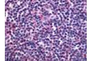 Anti-S1PR4 / EDG6 antibody IHC of human lymph node. (S1PR4 anticorps  (Cytoplasmic Domain))