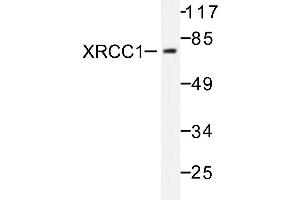 Image no. 1 for anti-X-Ray Repair Complementing Defective Repair in Chinese Hamster Cells 1 (XRCC1) antibody (ABIN271979) (XRCC1 anticorps)