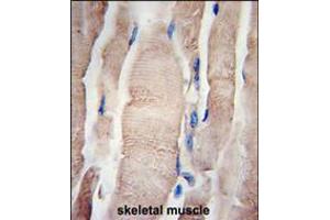 Formalin-fixed and paraffin-embedded human skeletal muscle tissue reacted with PHPT1 Antibody , which was peroxidase-conjugated to the secondary antibody, followed by DAB staining.