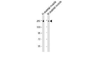 All lanes : Anti-MYH8 Antibody (N-Term) at 1:1000 dilution Lane 1: human skeletal muscle lysate Lane 2: mouse skeletal muscle lysate Lysates/proteins at 20 μg per lane.