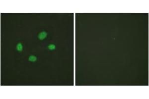 Immunofluorescence analysis of HeLa cells, using Chk2 (Phospho-Thr383) Antibody.