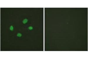 Immunofluorescence analysis of HeLa cells, using Chk2 (Phospho-Thr383) Antibody. (CHEK2 anticorps  (pThr383))