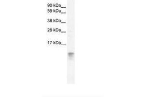 Image no. 2 for anti-Fatty Acid Binding Protein 3, Muscle and Heart (FABP3) (AA 46-95) antibody (ABIN202026)