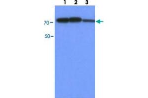 Western blot analysis of HepG2 cell lysate (30 ug) by using PFKM monoclonal antibody, clone AT2F11  (1:500-1:2000). (PFKM anticorps  (AA 1-780))