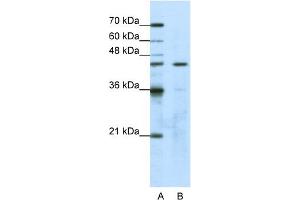 WB Suggested Anti-GTPBP9 Antibody Titration:  1. (OLA1 anticorps  (N-Term))