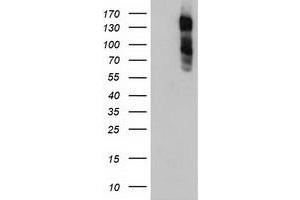 HEK293T cells were transfected with the pCMV6-ENTRY control (Left lane) or pCMV6-ENTRY ENPEP (Right lane) cDNA for 48 hrs and lysed. (ENPEP anticorps)