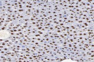 Immunohistochemistry analysis of paraffin-embedded mouse liver using,SET (ABIN7075583) at dilution of 1: 10000