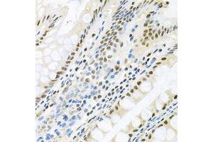 Immunohistochemistry of paraffin-embedded human colon using MAPK8 antibody.
