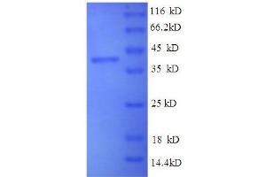 Brain-Derived Neurotrophic Factor (BDNF) (AA 137-237), (partial) protein (GST tag)