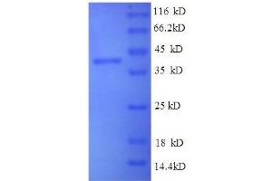 SDS-PAGE (SDS) image for Brain-Derived Neurotrophic Factor (BDNF) (AA 137-237), (partial) protein (GST tag) (ABIN1046634) (BDNF Protein (AA 137-237, partial) (GST tag))