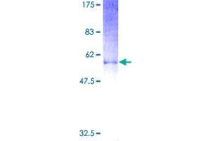 Image no. 1 for Proenkephalin (PENK) (AA 1-267) protein (GST tag) (ABIN1314653)