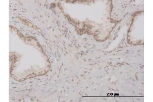 Immunoperoxidase of monoclonal antibody to FOXO3A on formalin-fixed paraffin-embedded human prostate. (FOXO3 anticorps  (AA 361-460))