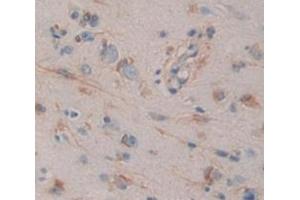 Used in DAB staining on fromalin fixed paraffin- embedded brain tissue