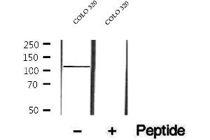 Western blot analysis of extracts of COLO 320 cells, using p107 antibody. (p107 anticorps  (C-Term))