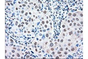 Image no. 5 for anti-Mitogen-Activated Protein Kinase 1 (MAPK1) antibody (ABIN1499291) (ERK2 anticorps)