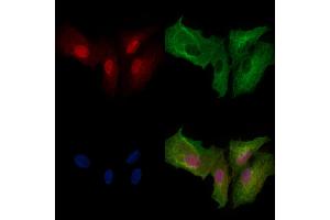 Phospho-PFKFB3 (Ser461) Antibody staining A549 cells(heat shock treatment) by IF/ICC. (PFKFB3 anticorps  (pSer461))