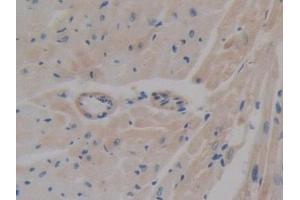 Detection of ABCA1 in Mouse Heart Tissue using Polyclonal Antibody to ATP Binding Cassette Transporter A1 (ABCA1)
